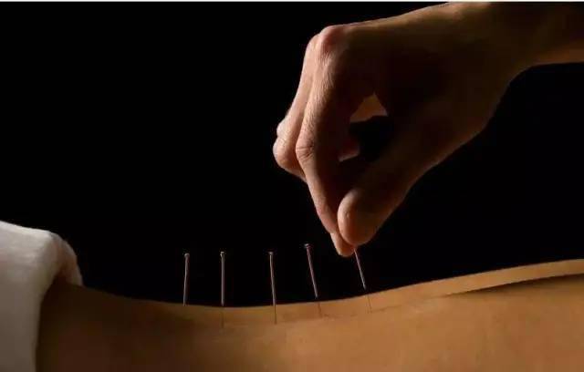 平衡針灸最新視頻，現(xiàn)代應(yīng)用探索針灸藝術(shù)的新境界