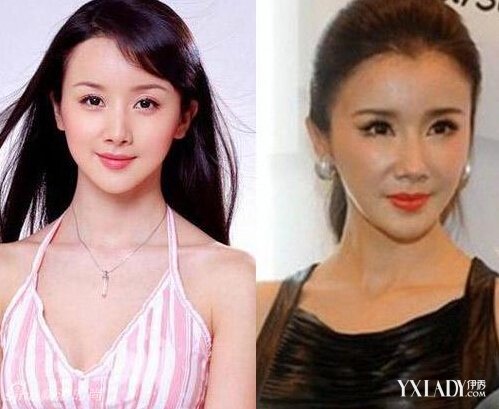 探秘明星整容的秘密，神秘美容小店的魅力所在！